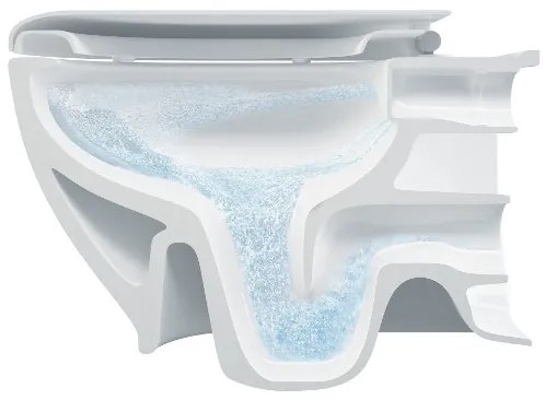 Bruckner - WC suspendat Rimless WALTER ceramică/culoare albă