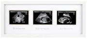 Pearhead - Rama foto pentru ecografii