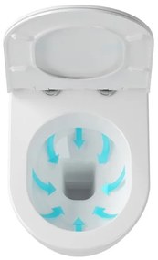 Ravak X01516 - Vas WC suspendat UNI CHROME, ceramică/albă