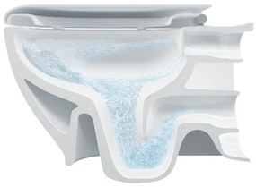 Bruckner - WC suspendat Rimless WALTER ceramică/culoare albă